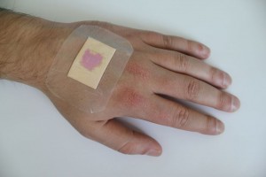 wound