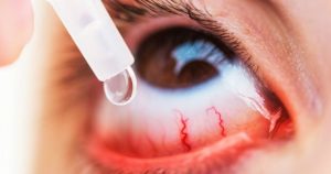eye drops