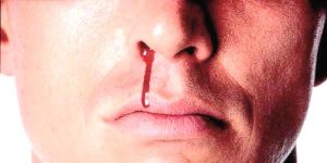 nose