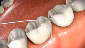 daily-flossing-technique