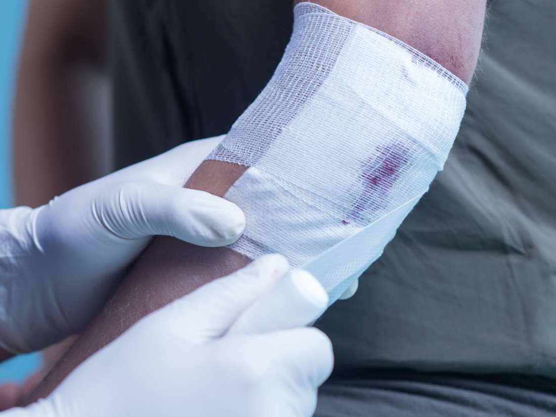 [QID0697] Does applying medicine or a medicinal bandage on a wound