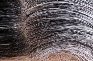 White hair