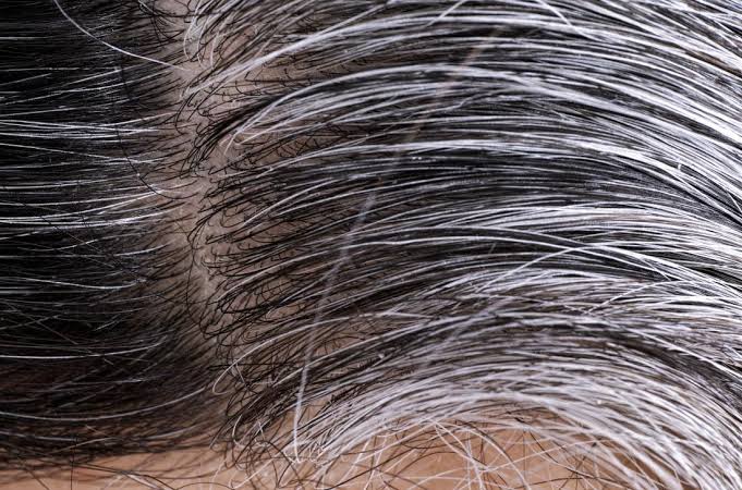 White hair